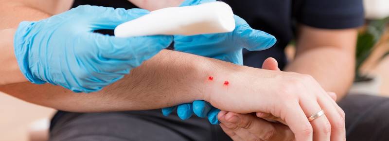 Mơ thấy rắn cắn là điềm gì?