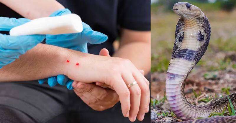 Rắn cắn vào tay